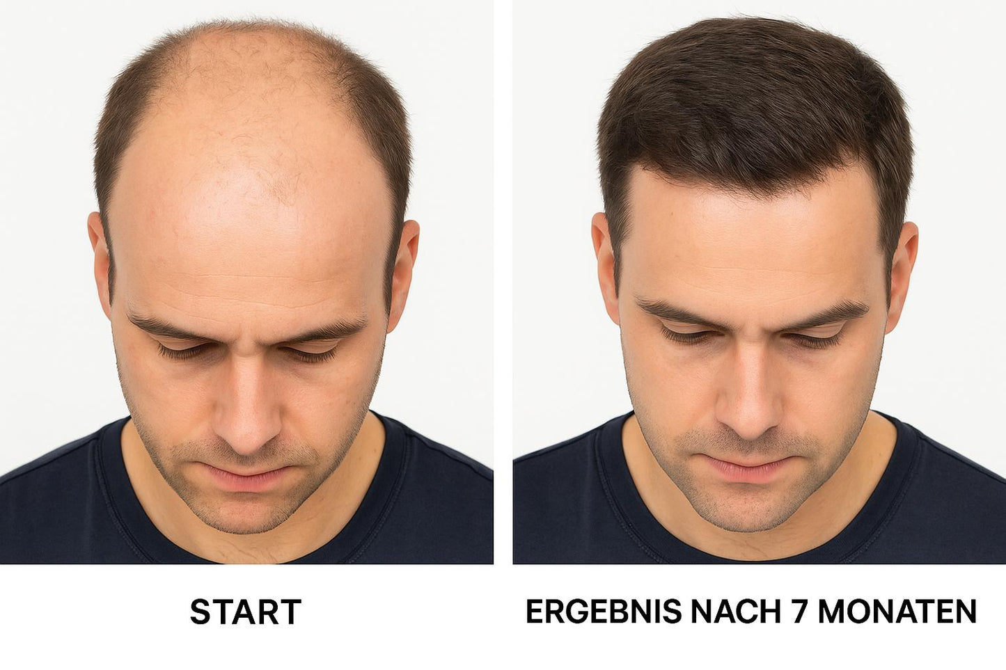 Aetheria® - Rotlicht-Kopfmassagegerät