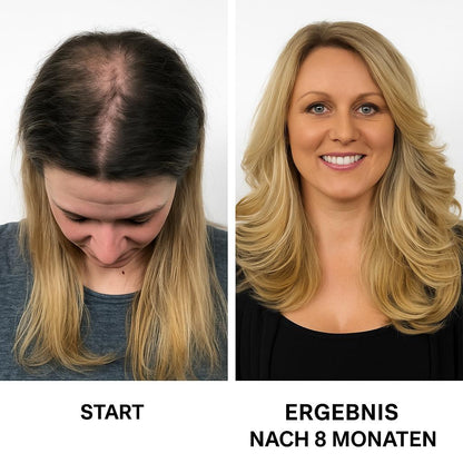 Aetheria® - Rotlicht-Kopfmassagegerät