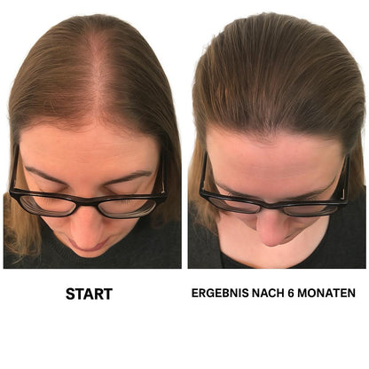 Aetheria® - Rotlicht-Kopfmassagegerät